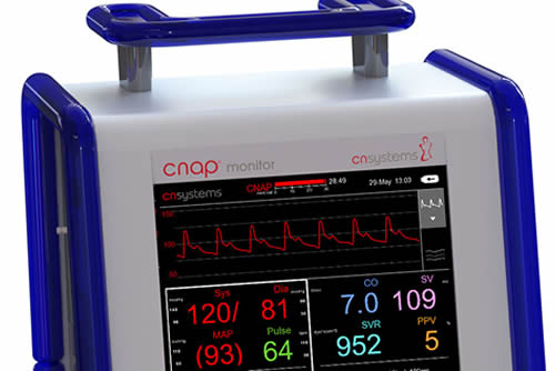 CNAP Monitor for non-invasive hemodynamic monitoring