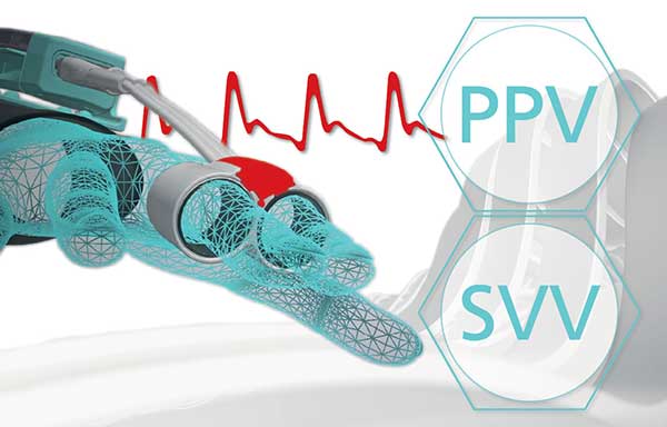 CNAP PPV SVV Technology