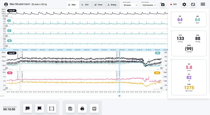 Task Force CARDIO Software