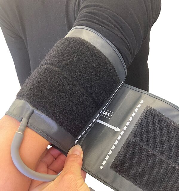 NBP Upper arm measurement