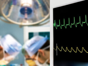 continuous hemodynamic monitoring in surgery